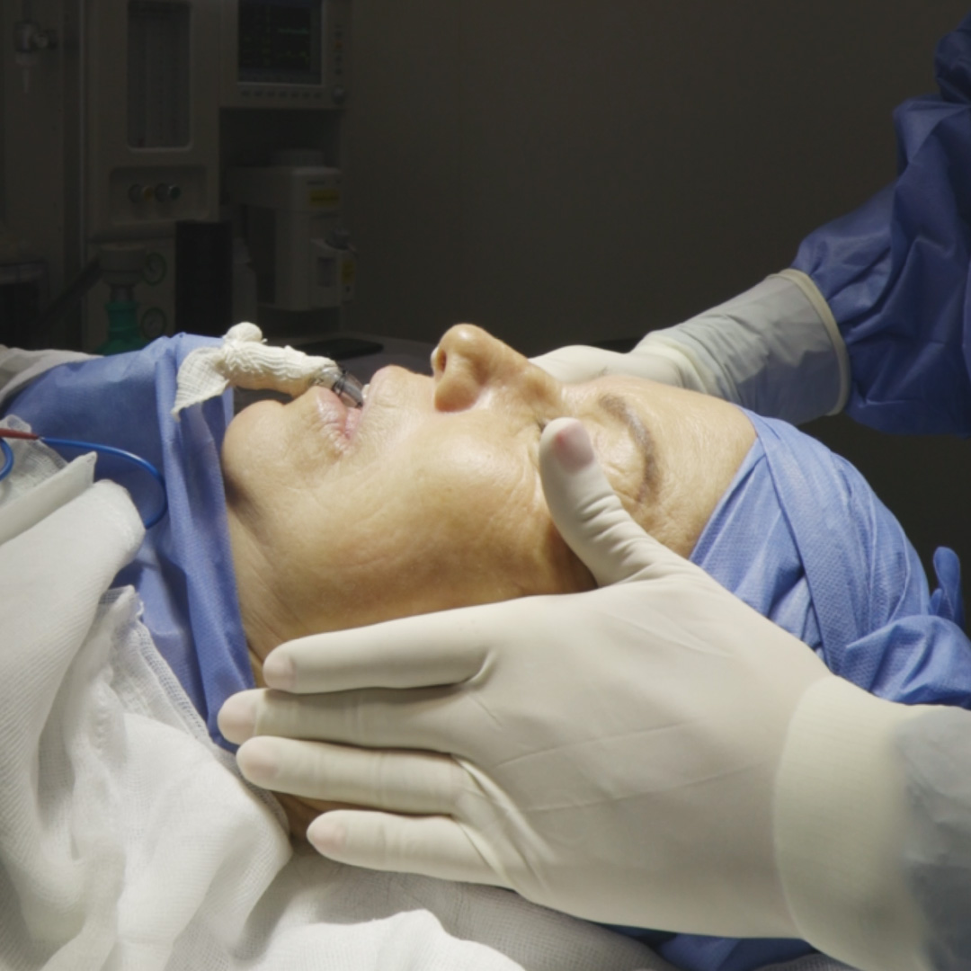 Cirugia de Rejuvenecimiento Facial