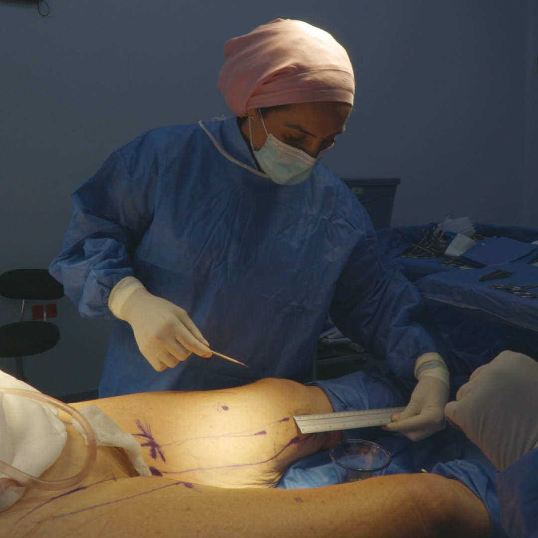 Liftingespiraldelmuslo